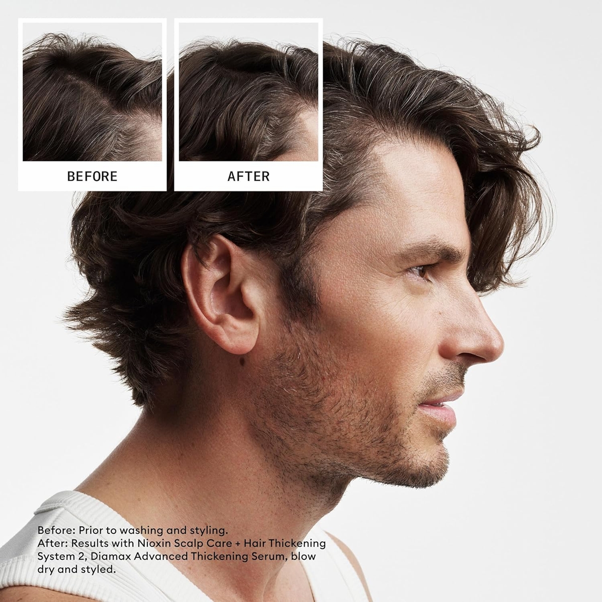 nioxin2 3set2 nioxin2 3set2