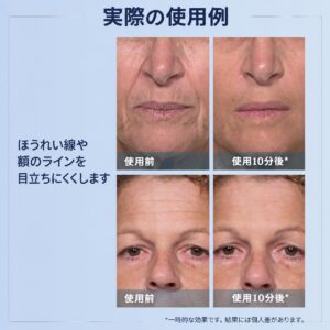 plexraderm results