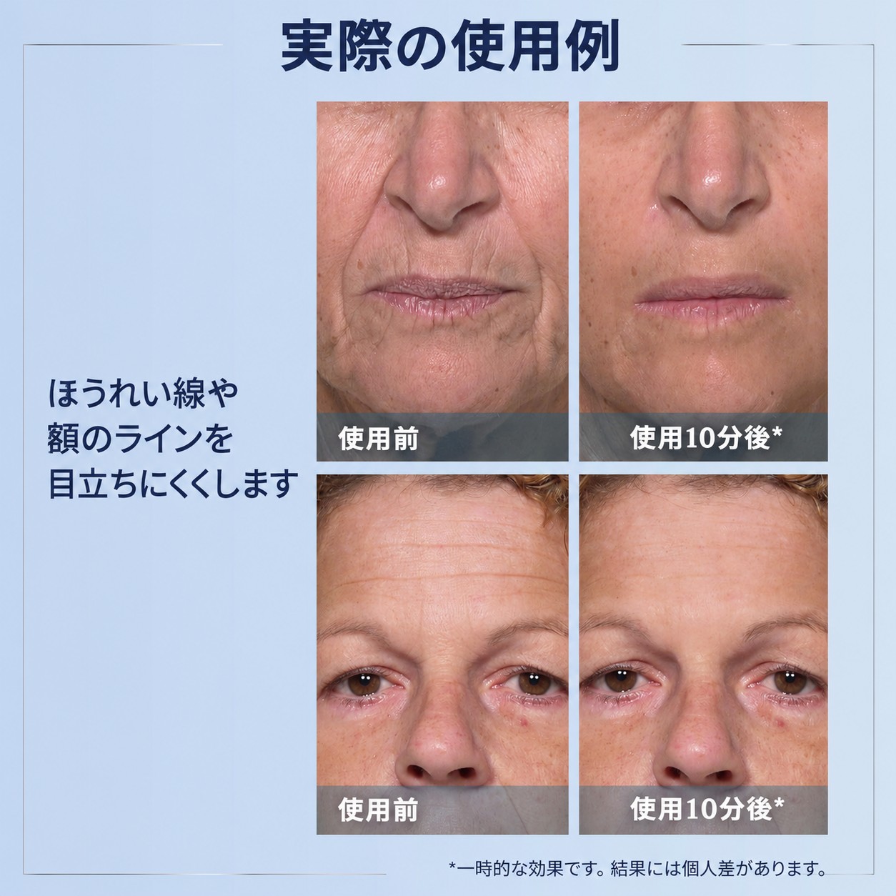 plexraderm results plexraderm results
